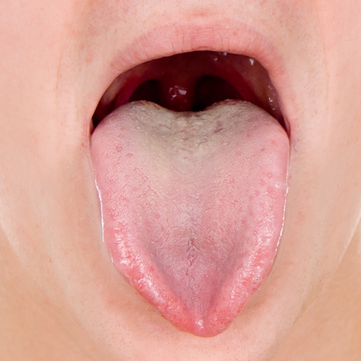 Tongues